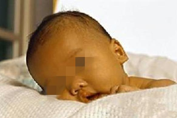 新生兒腦損傷有什么異常表現(xiàn) 新生兒腦損傷異常表現(xiàn)行為 新生兒腦損傷有什么異常表現(xiàn) 新生兒腦損傷異常表現(xiàn)行為