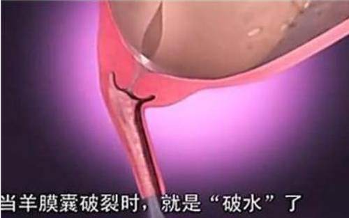 自然分娩全過程是怎么樣的 自然分娩過程圖解