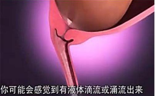 自然分娩全過程是怎么樣的 自然分娩過程圖解