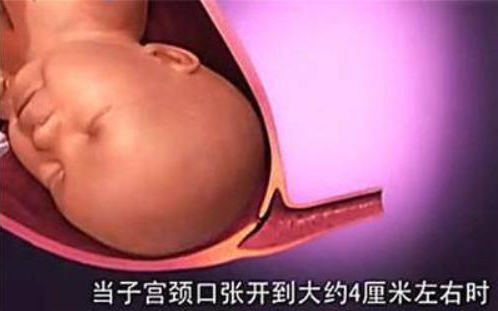 自然分娩全過程是怎么樣的 自然分娩過程圖解