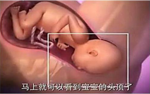 自然分娩全過程是怎么樣的 自然分娩過程圖解