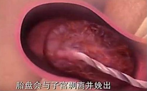 自然分娩全過程是怎么樣的 自然分娩過程圖解