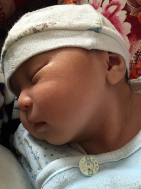 寶寶頭歪是斜頸嗎 寶寶睡覺總是偏向一邊怎么辦