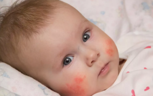 寶寶換奶不適應(yīng)怎么辦 寶寶換奶不適注意事項(xiàng)