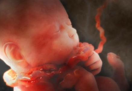 孕婦什么行為會導致胎兒臍帶繞頸 胎兒臍帶繞頸怎么辦