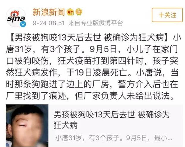 孩子被狗咬了怎么辦 孩子被狗咬傷處理方法