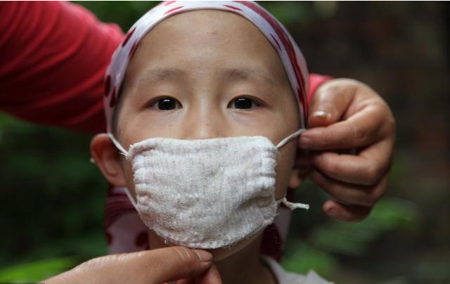 孩子得了白血病有什么癥狀表現 如何預防孩子得白血病 孩子得了白血病有什么癥狀表現 如何預防孩子得白血病