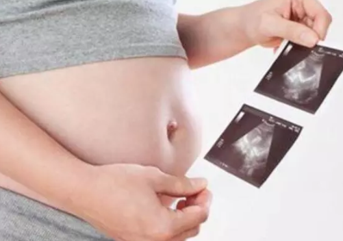 孕婦四維彩超需要空腹嗎 四維彩超需要憋尿嗎