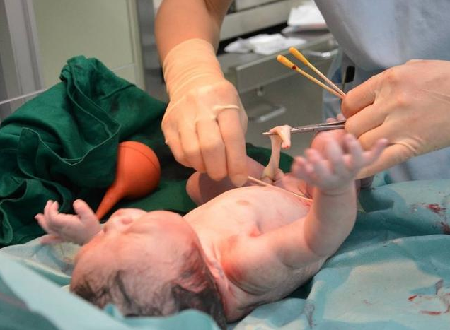 七個月羊水破了孩子能活嗎 羊水早破保胎能保多久