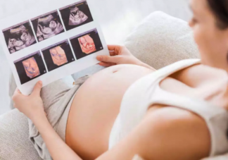 做四維彩超需要注意什么 四維彩超的準備工作