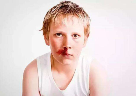 寶寶流鼻血可以仰頭嗎 寶寶流鼻血要不要仰頭 寶寶流鼻血可以仰頭嗎 寶寶流鼻血要不要仰頭