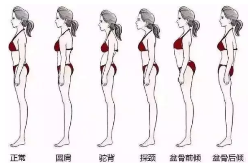 產后腹直肌分離有哪些危害 腹直肌分離的危害