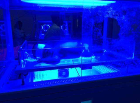 新生兒黃疸照藍光有必要嗎 新生兒什么情況要照藍光