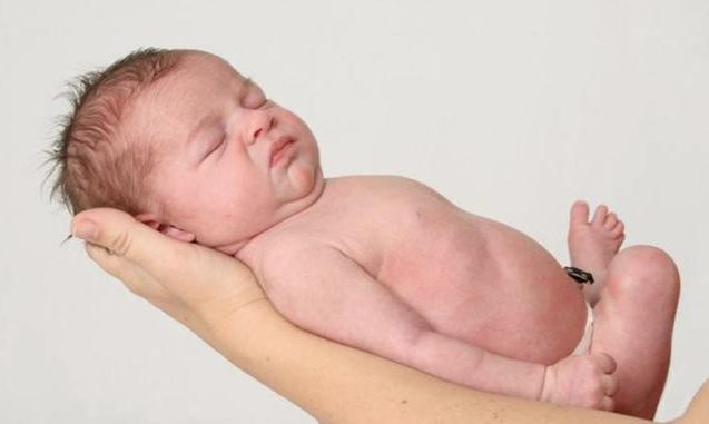 新生兒黃疸照藍光有必要嗎 新生兒什么情況要照藍光