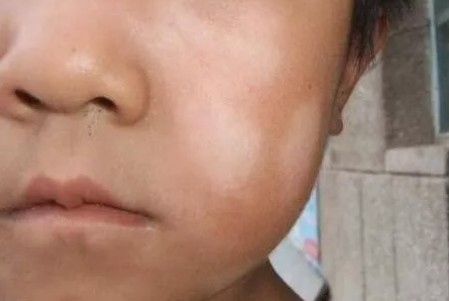 孩子磨牙多影響智力嗎 孩子經(jīng)常磨牙怎么辦