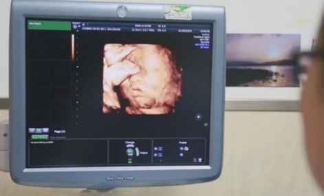 女兒借母親子宮生寶寶是怎么回事 女兒借母親子宮成功了嗎 女兒借母親子宮生寶寶是怎么回事 女兒借母親子宮成功了嗎