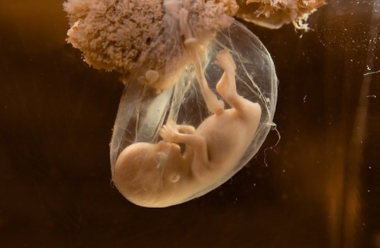 孕婦羊水偏少怎么回事 羊水偏少的原因 孕婦羊水偏少怎么回事 羊水偏少的原因