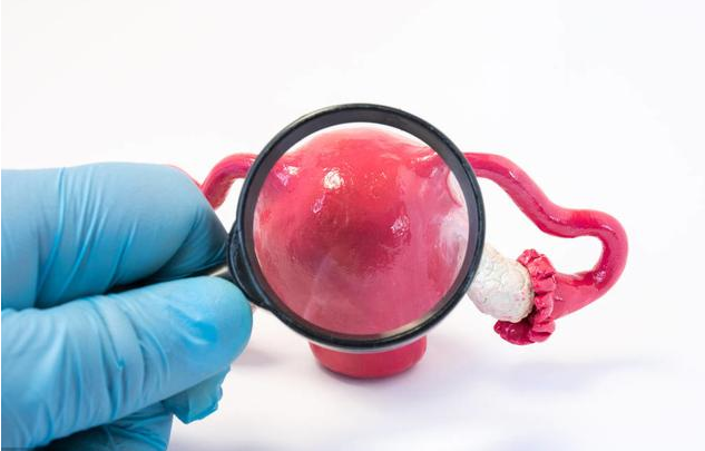 女性宮頸長痘痘是怎么回事 宮頸囊腫會變成宮頸癌嗎 女性宮頸長痘痘是怎么回事 宮頸囊腫會變成宮頸癌嗎