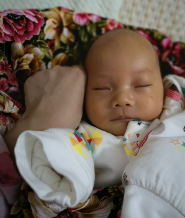 新生兒黃疸常見嗎 新生兒黃疸會有什么并發癥 新生兒黃疸常見嗎 新生兒黃疸會有什么并發癥