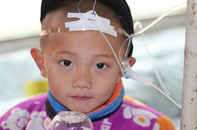 為什么寶寶輸液扎針在頭部 寶寶輸液在頭部扎針對大腦有影響嗎