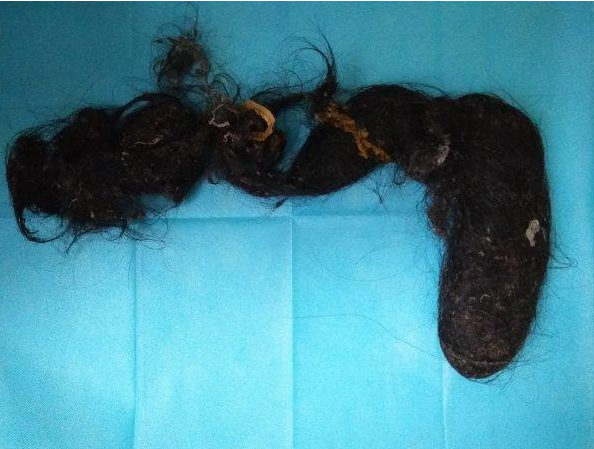 兒童異食癖是什么原因 孩子出現異食癖怎么辦 兒童異食癖是什么原因 孩子出現異食癖怎么辦