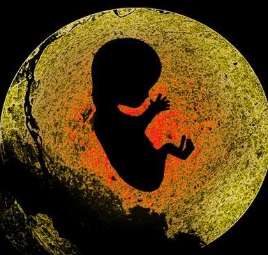 女性打引產(chǎn)針有哪些危害 女性引產(chǎn)后注意事項 女性打引產(chǎn)針有哪些危害 女性引產(chǎn)后注意事項