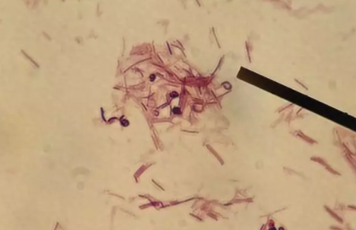 為什么寶寶吃點肉就便秘 春節寶寶便秘解決方法