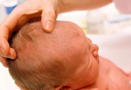 寶寶鹵門閉合的時間 鹵門閉合晚什么原因 寶寶鹵門閉合的時間 鹵門閉合晚什么原因