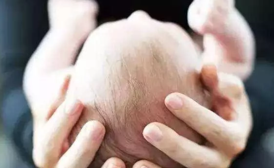 寶寶鹵門凹陷是怎么回事 鹵門凹陷是缺鈣嗎