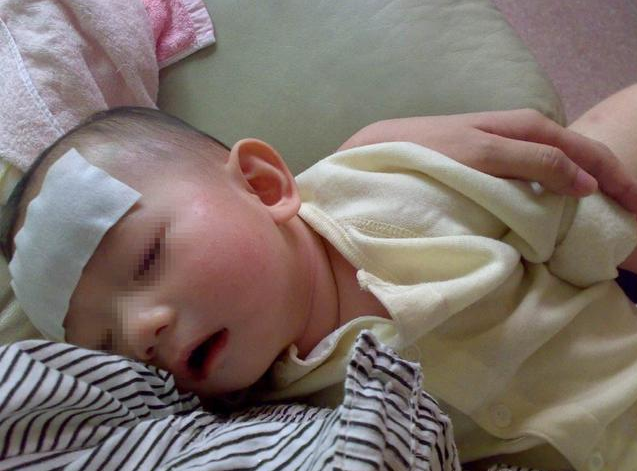 孩子發(fā)燒怎么退燒 孩子發(fā)燒什么時候要送醫(yī)院