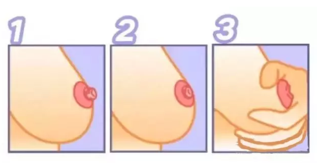 產(chǎn)后乳房問題匯總 影響奶水質(zhì)量的乳房問題 產(chǎn)后乳房問題匯總 影響奶水質(zhì)量的乳房問題