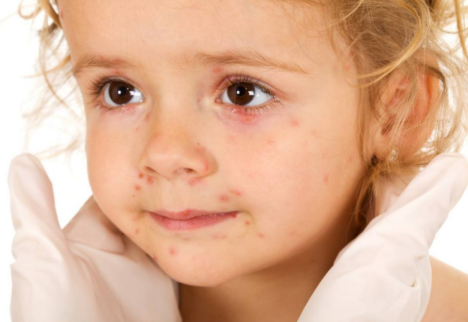 造成孩子過敏體質的原因 過敏體質是什么原因造成的