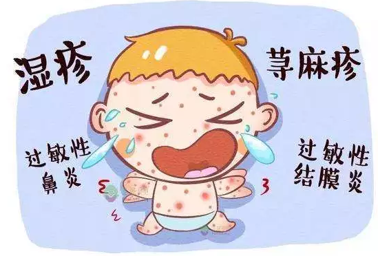 寶寶過(guò)敏體質(zhì)怎么改善 寶寶過(guò)敏體質(zhì)改善方法