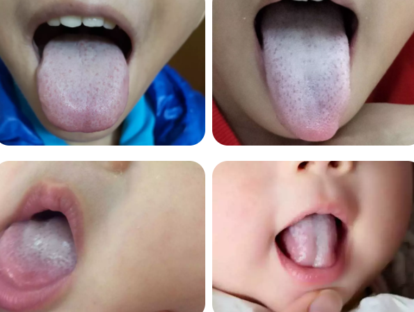 怎么判斷孩子濕氣重 孩子濕氣重辨別方法 怎么判斷孩子濕氣重 孩子濕氣重辨別方法