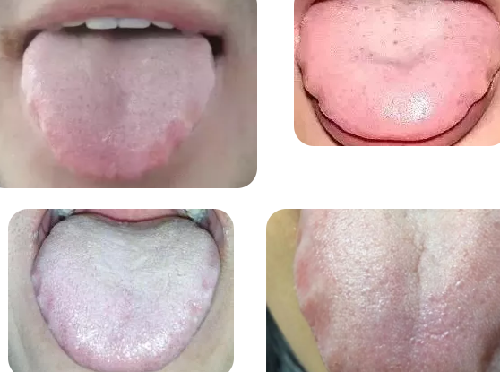 怎么判斷孩子濕氣重 孩子濕氣重辨別方法 怎么判斷孩子濕氣重 孩子濕氣重辨別方法