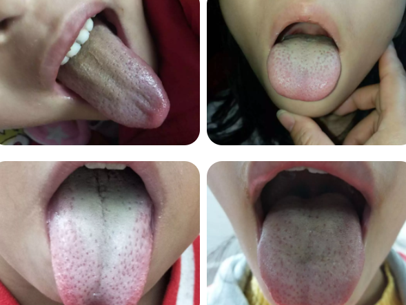 怎么判斷孩子濕氣重 孩子濕氣重辨別方法 怎么判斷孩子濕氣重 孩子濕氣重辨別方法