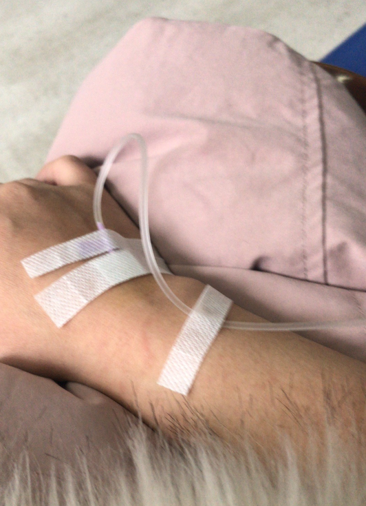 孩子發燒圖片說說心情 關于孩子發燒的心情說說