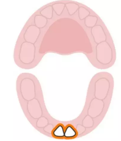 寶寶換牙時間表2019 兒童換牙時間順序 寶寶換牙時間表2019 兒童換牙時間順序