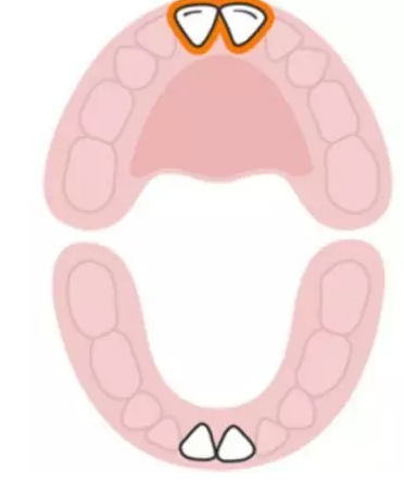 寶寶換牙時間表2019 兒童換牙時間順序 寶寶換牙時間表2019 兒童換牙時間順序