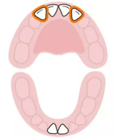 寶寶換牙時間表2019 兒童換牙時間順序 寶寶換牙時間表2019 兒童換牙時間順序