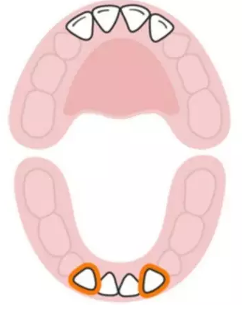 寶寶換牙時間表2019 兒童換牙時間順序 寶寶換牙時間表2019 兒童換牙時間順序
