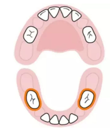 寶寶換牙時間表2019 兒童換牙時間順序 寶寶換牙時間表2019 兒童換牙時間順序