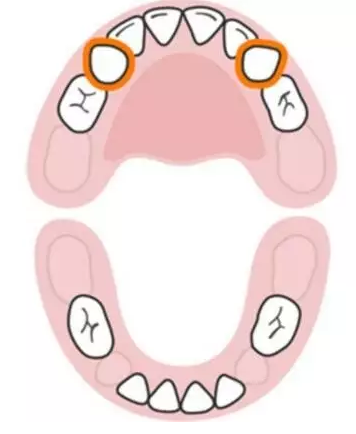 寶寶換牙時間表2019 兒童換牙時間順序 寶寶換牙時間表2019 兒童換牙時間順序