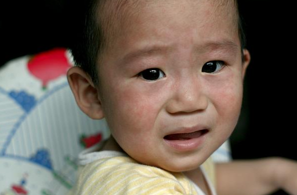 幼兒急疹護理方法 如何判斷是否是幼兒急疹