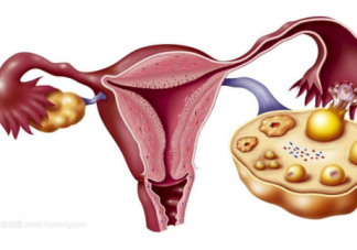 輸卵管積水怎么治療 輸卵管積水治療方法