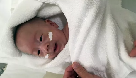 世界最小的嬰兒多重 世界最小男嬰體重是4個雞蛋