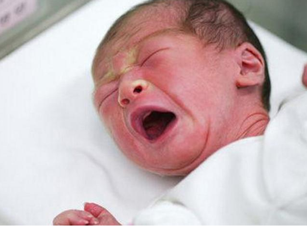 新生兒黃疸多久能退 新生兒黃疸怎么護(hù)理 新生兒黃疸多久能退 新生兒黃疸怎么護(hù)理