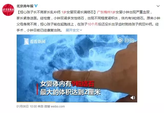 孩子補鈣得結石是什么情況 給孩子過度補鈣有什么影響