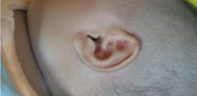 寶寶耳屎要不要掏 清理寶寶耳屎的日常護理小妙招