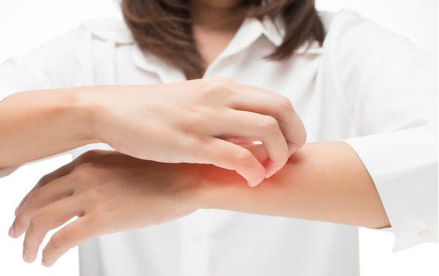 孕期皮膚瘙癢正常嗎 孕期皮膚瘙癢怎么辦